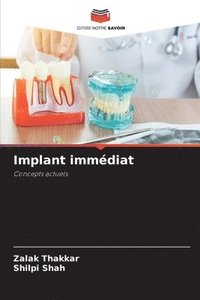 bokomslag Implant immdiat