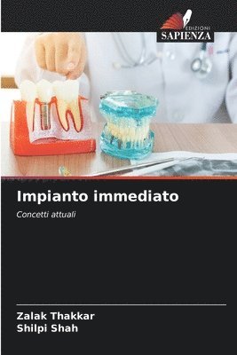 bokomslag Impianto immediato