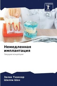 bokomslag &#1053;&#1077;&#1084;&#1077;&#1076;&#1083;&#1077;&#1085;&#1085;&#1072;&#1103; &#1080;&#1084;&#1087;&#1083;&#1072;&#1085;&#1090;&#1072;&#1094;&#1080;&#1103;