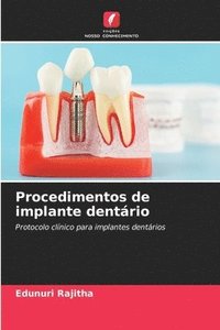 bokomslag Procedimentos de implante dentrio