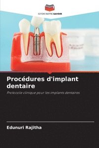 bokomslag Procdures d'implant dentaire