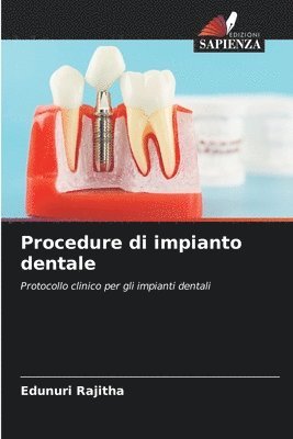 bokomslag Procedure di impianto dentale