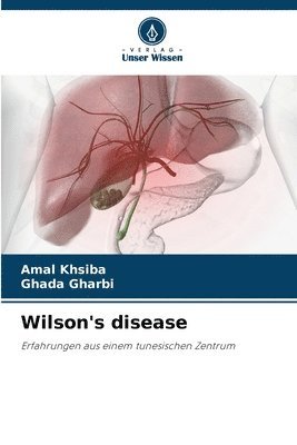 Wilson's disease 1
