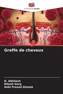 bokomslag Greffe de cheveux