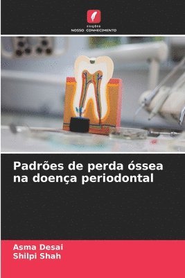 bokomslag Padres de perda ssea na doena periodontal