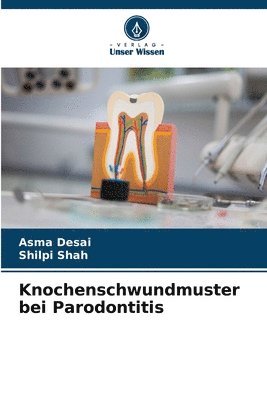 Knochenschwundmuster bei Parodontitis 1