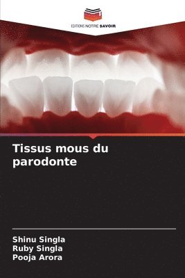 Tissus mous du parodonte 1