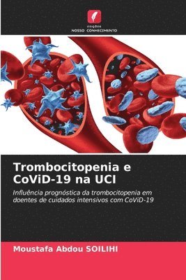 Trombocitopenia e CoViD-19 na UCI 1