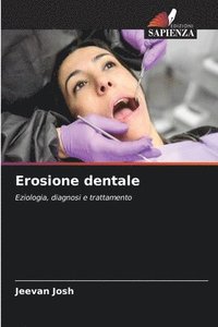 bokomslag Erosione dentale
