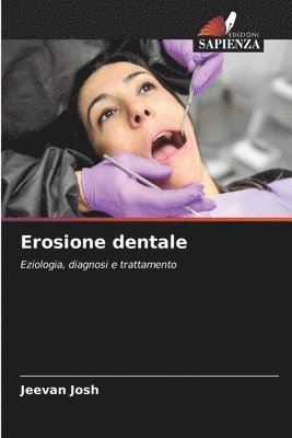 Erosione dentale 1