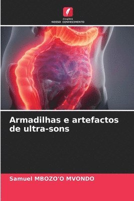 bokomslag Armadilhas e artefactos de ultra-sons