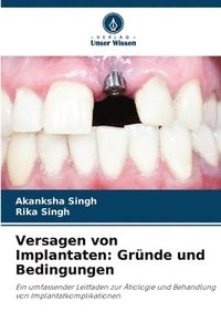 bokomslag Versagen von Implantaten: Gründe und Bedingungen