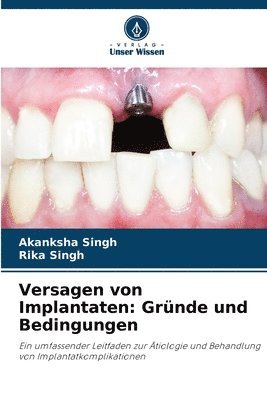 bokomslag Versagen von Implantaten: Gründe und Bedingungen