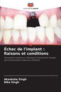 bokomslag Échec de l'implant