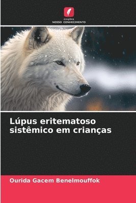 Lpus eritematoso sistmico em crianas 1