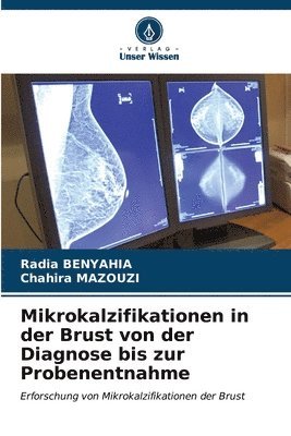 bokomslag Mikrokalzifikationen in der Brust von der Diagnose bis zur Probenentnahme