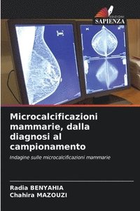 bokomslag Microcalcificazioni mammarie, dalla diagnosi al campionamento