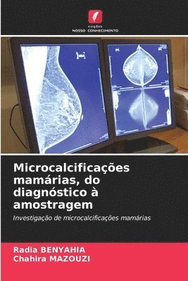 Microcalcificaes mamrias, do diagnstico  amostragem 1