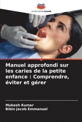 bokomslag Manuel approfondi sur les caries de la petite enfance