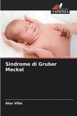 Sindrome di Gruber Meckel 1