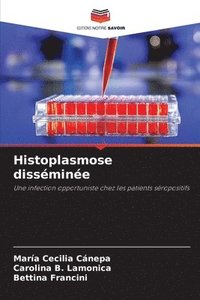 bokomslag Histoplasmose dissmine