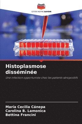 Histoplasmose dissmine 1
