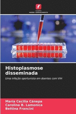 bokomslag Histoplasmose disseminada