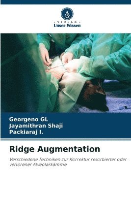 Ridge Augmentation 1