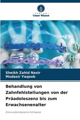 bokomslag Behandlung von Zahnfehlstellungen von der Pradoleszenz bis zum Erwachsenenalter