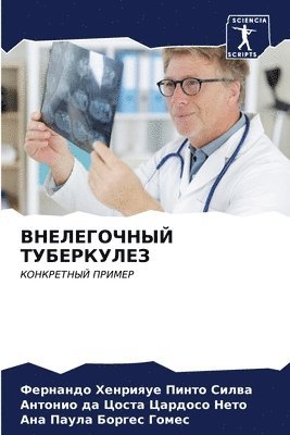 &#1042;&#1053;&#1045;&#1051;&#1045;&#1043;&#1054;&#1063;&#1053;&#1067;&#1049; &#1058;&#1059;&#1041;&#1045;&#1056;&#1050;&#1059;&#1051;&#1045;&#1047; 1