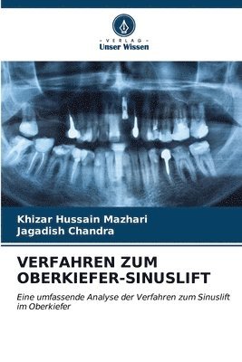 bokomslag Verfahren Zum Oberkiefer-Sinuslift