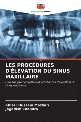 Les Procdures d'lvation Du Sinus Maxillaire 1