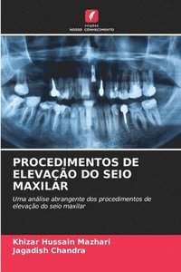 bokomslag Procedimentos de Elevao Do Seio Maxilar