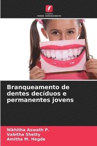 bokomslag Branqueamento de dentes decduos e permanentes jovens