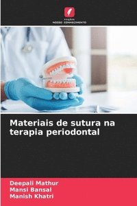 bokomslag Materiais de sutura na terapia periodontal