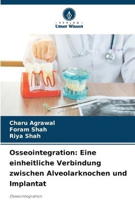 bokomslag Osseointegration