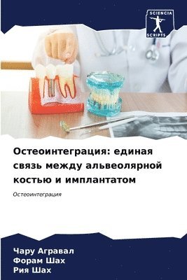 &#1054;&#1089;&#1090;&#1077;&#1086;&#1080;&#1085;&#1090;&#1077;&#1075;&#1088;&#1072;&#1094;&#1080;&#1103; 1