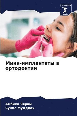 &#1052;&#1080;&#1085;&#1080;-&#1080;&#1084;&#1087;&#1083;&#1072;&#1085;&#1090;&#1072;&#1090;&#1099; &#1074; &#1086;&#1088;&#1090;&#1086;&#1076;&#1086;&#1085;&#1090;&#1080;&#1080; 1