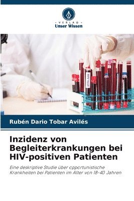 bokomslag Inzidenz von Begleiterkrankungen bei HIV-positiven Patienten