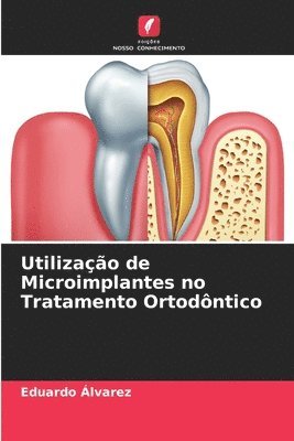 bokomslag Utilizao de Microimplantes no Tratamento Ortodntico