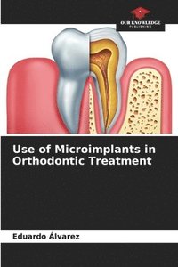 bokomslag Use of Microimplants in Orthodontic Treatment