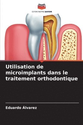 bokomslag Utilisation de microimplants dans le traitement orthodontique