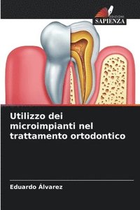 bokomslag Utilizzo dei microimpianti nel trattamento ortodontico