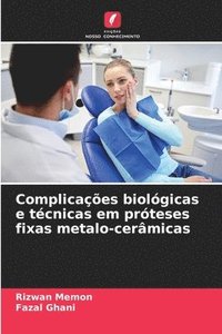 bokomslag Complicaes biolgicas e tcnicas em prteses fixas metalo-cermicas