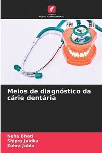 bokomslag Meios de diagnstico da crie dentria
