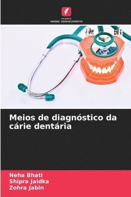 Meios de diagnstico da crie dentria 1