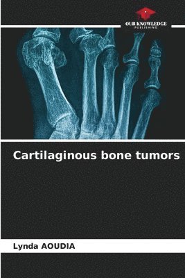 Cartilaginous bone tumors 1