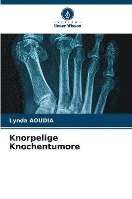 Knorpelige Knochentumore 1