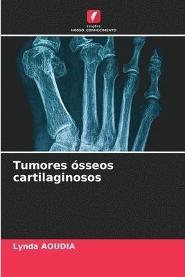 Tumores sseos cartilaginosos 1