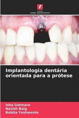 bokomslag Implantologia dentria orientada para a prtese